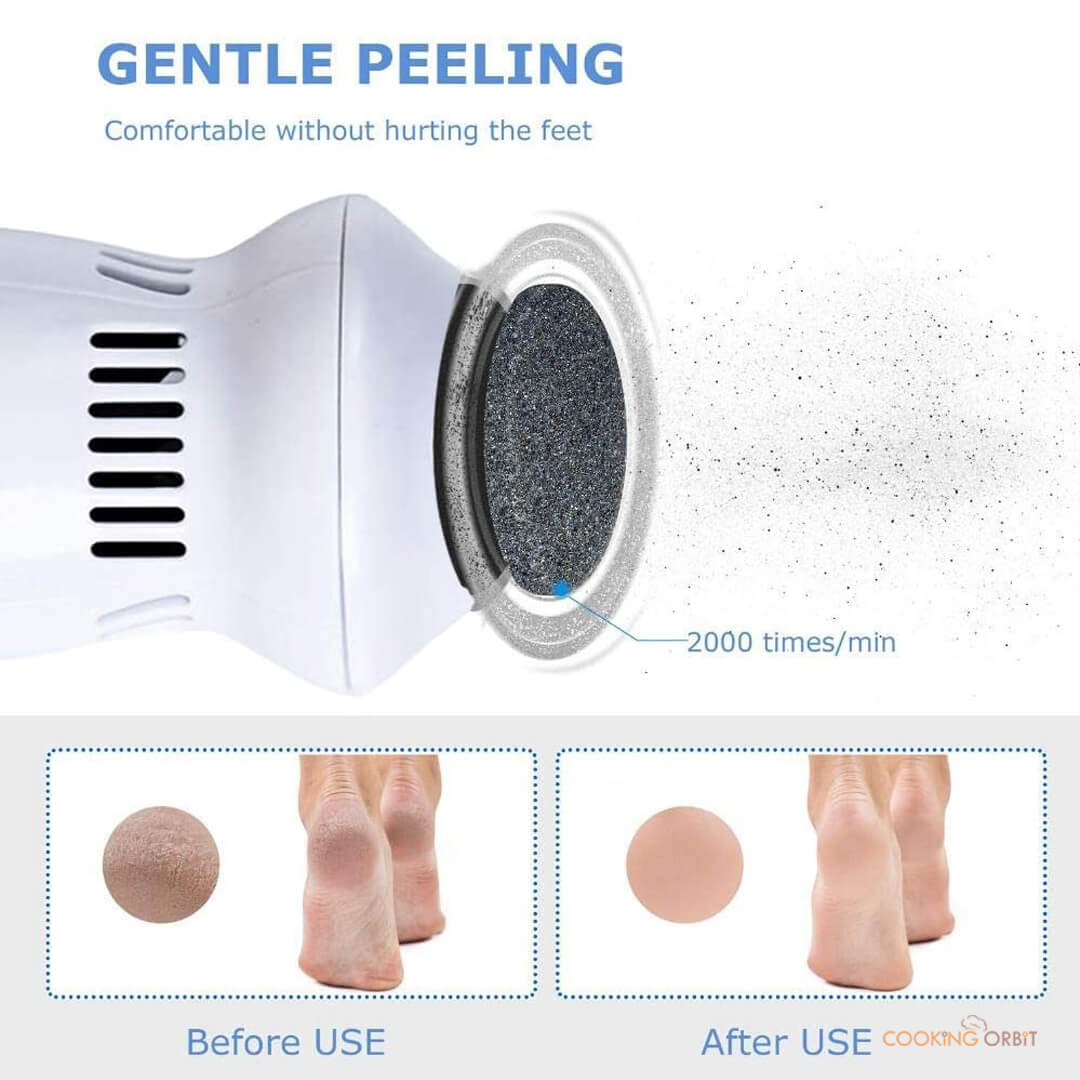 New Original Foot Pedicure Grinder Remover Tools Electric Automatic Polisher File Dead Skin Callus Feet Care Cleaning Foot File Care Tool Remover Absorbing Machine Dead Skin Callus Polisher Electric Automatic Polisher Foot Pedicure Grinder Remover Feet
